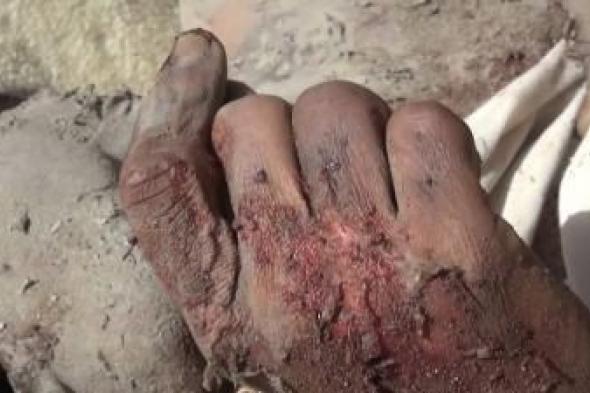 أخبار اليمن : 12 شهيداً وجريحاً بعدوان على الحديدة وصعدة