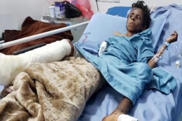 أخبار اليمن : إصابة طفلين بانفجار لغم من مخلفات العدوان في الحديدة