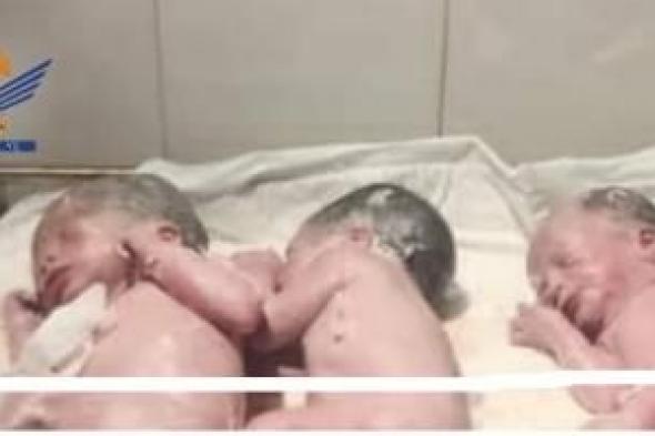 أخبار اليمن : ولادة 3 توائم بعملية قيصرية
