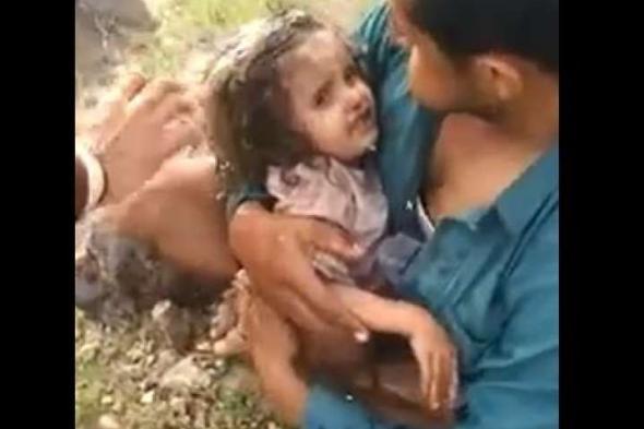 اليمن : اتفرج طفلة يمنية بعد ان دفنتها زوجة ابيها في حفرة بذمار وهكذا كان مصيره