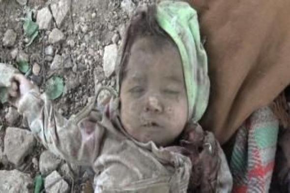 أخبار اليمن : استشهاد 3860 طفلاً وجرح 4256 منذ بدء العدوان