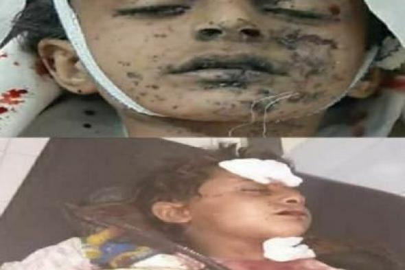 أخبار اليمن : في يومهم العالمي.. أطفال اليمن ضحايا مخلفات العدوان