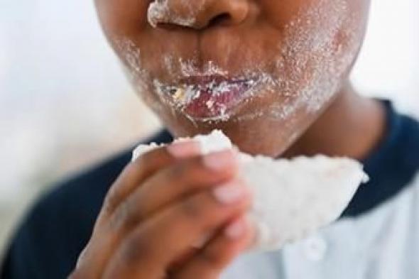 أخبار اليمن : عندما تتناول كثيراً من السكر.. ماذا يحدث في جسمك؟