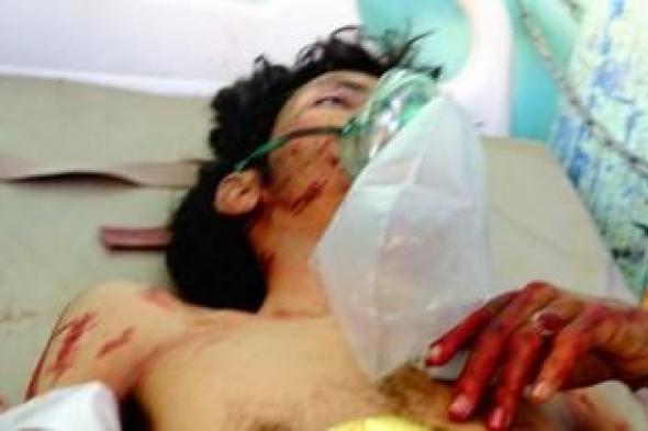 أخبار اليمن : جرائم العدوان في مثل هذا اليوم 2 أكتوبر