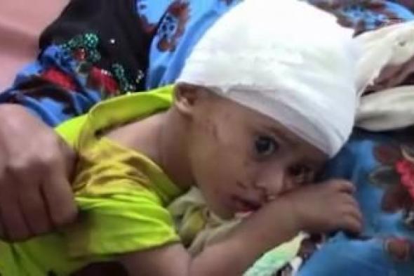أخبار اليمن : جرائم العدوان في مثل هذا اليوم 3 أكتوبر
