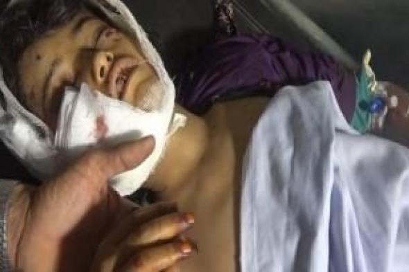 أخبار اليمن : جرائم العدوان في مثل هذا اليوم 18 أكتوبر