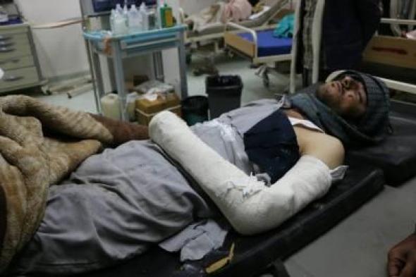 أخبار اليمن : جرائم العدوان في مثل هذا اليوم 31 أكتوبر