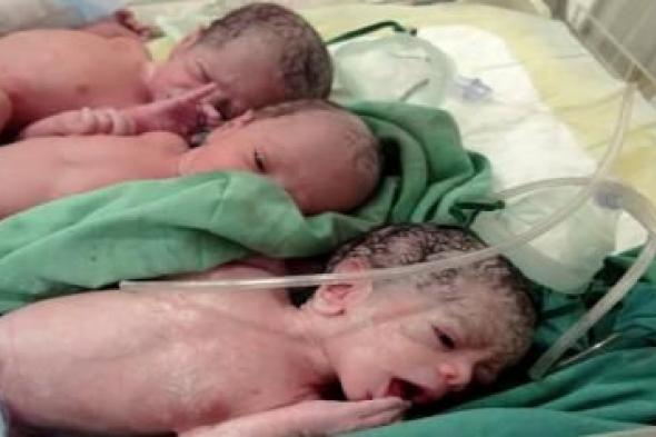 أخبار اليمن : ولادة ثلاثة توائم في مستشفى الكويت الجامعي