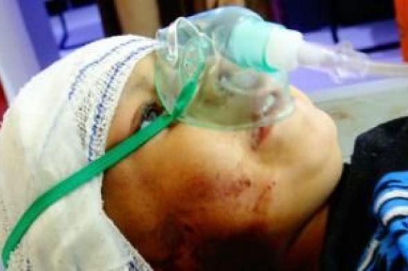 أخبار اليمن : جرائم العدوان في مثل هذا اليوم 7 نوفمبر