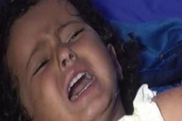 أخبار اليمن : جرائم العدوان في مثل هذا اليوم 9 نوفمبر