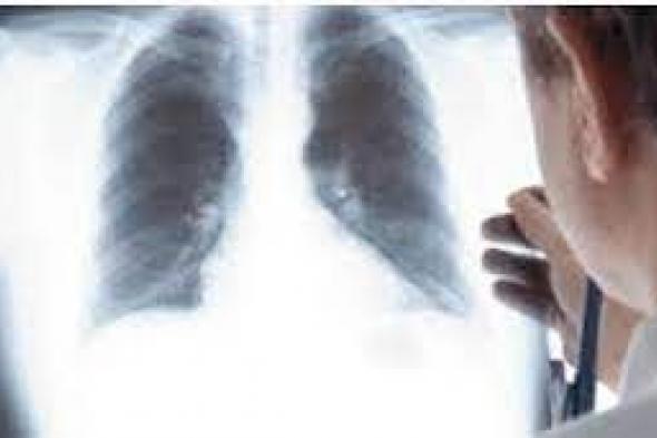 لماذا يصاب بعض المدخنين بسرطان الرئة والبعض الآخر لا يصاب ..دراسة تفجر مفاجأة!!
