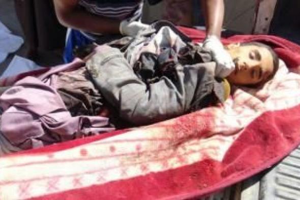 أخبار اليمن : جرائم العدوان في مثل هذا اليوم 18 نوفمبر