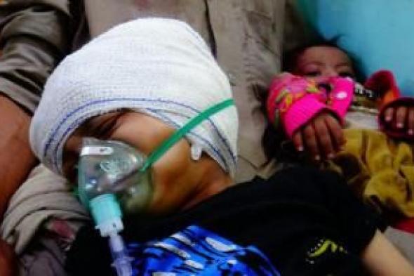 أخبار اليمن : جرائم العدوان في مثل هذا اليوم 27 نوفمبر