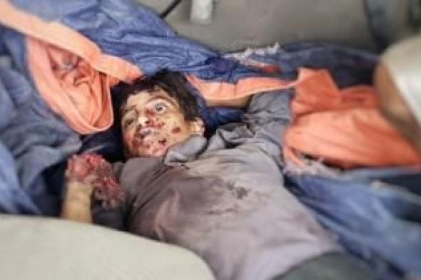 أخبار اليمن : مخلفات الحرب تقتل وتصيب 21 مدنياً في شهر