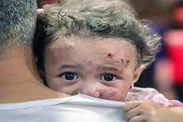 أخبار اليمن : ارتفاع عدد الشهداء في غزة إلى 15899