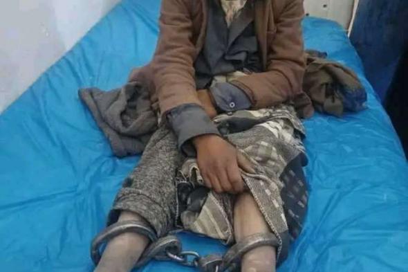 في اليمن.. أب يعتدي على ابنه الصغير و يقيده بالسلاسل لهذا السبب؟