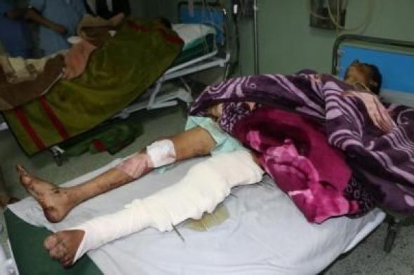 أخبار اليمن : جرائم العدوان في مثل هذا اليوم 22 ديسمبر