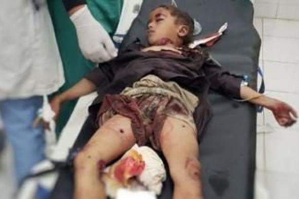 أخبار اليمن : انفجار مخلفات العدوان يصيب طفلين في صعدة