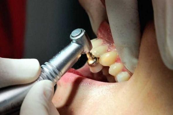 العالم اليوم - امرأة تقاضي طبيب أسنان.. أجرى لها 32 عملية في يوم واحد فقط