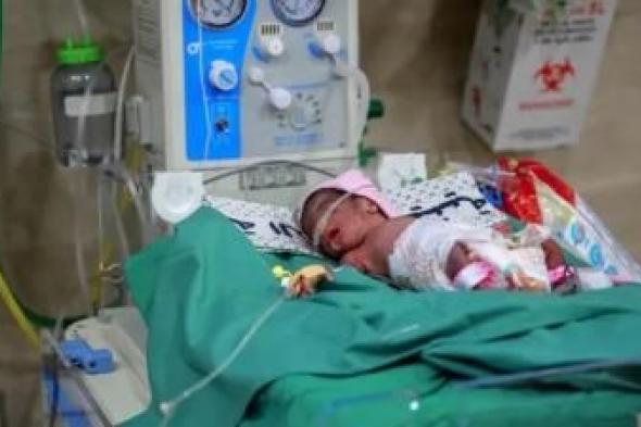 أخبار اليمن : صحة غزة: وفاة رضيعين نتيجة الجفاف وسوء التغذية