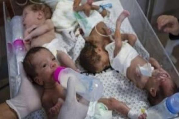 أخبار اليمن : الجفاف يقتل 4 أطفال في مستشفى بغزة