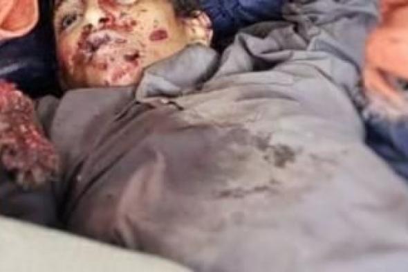 أخبار اليمن : انفجار عنقودية يودي بحياة طفل في صعدة