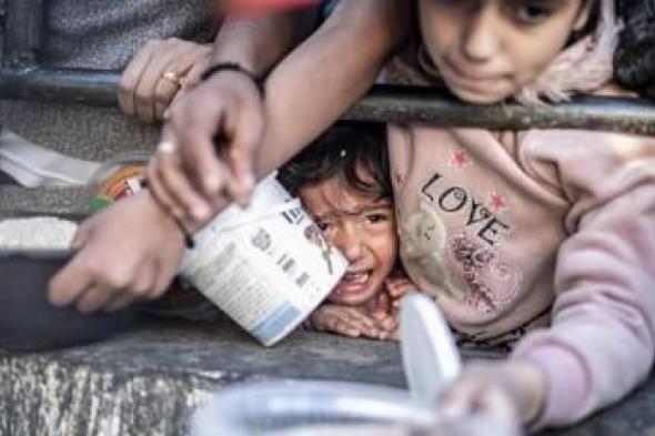 أخبار اليمن : الأونروا: طفل من بين 3 يعاني سوء تغذية حاد في غزة