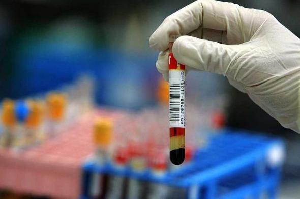 العالم اليوم - 6 اختبارات دم ضرورية تكشف أسرار صحتك