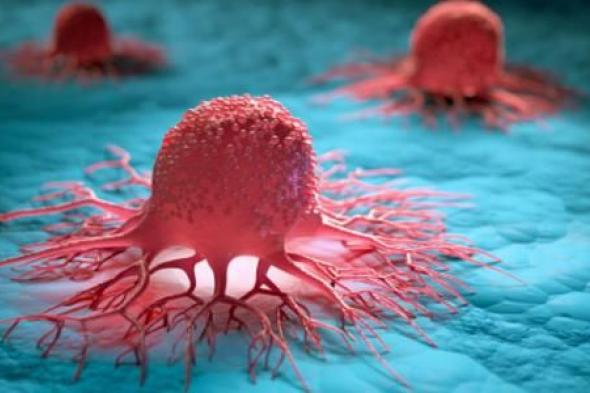 ضجة واسعة بعد إعلان فريق بحثي سعودي يكتشف نبات رهيب يقضي على الخلايا السرطانية في الجسم ويعلن عن اسمه للجميع!!